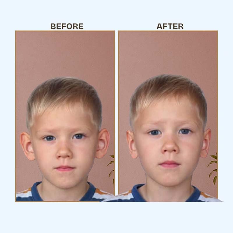 Corector Invizibil pentru Urechi